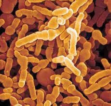 Bifidobacterium infantis